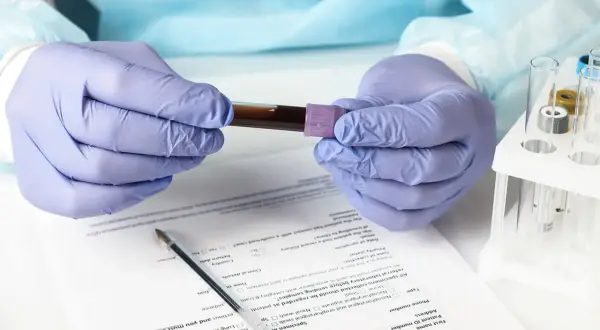 Ręce w rękawiczkach trzymają probówkę z krwią. Wyniki badań wskazują na eozynofile niskie.