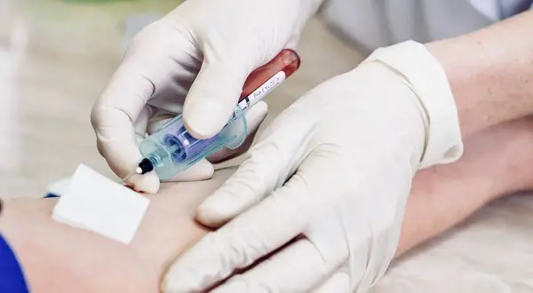 Czy badania krwi wykryją raka? Fakty i ograniczenia diagnostyki