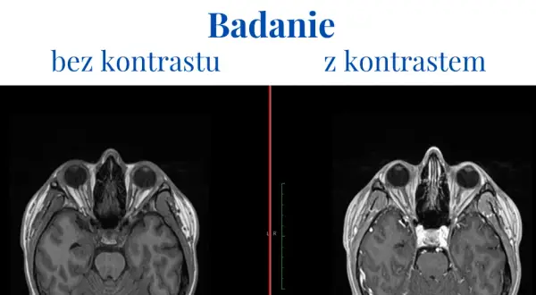 Alkohol po kontraście: czy można pić i jakie są zagrożenia?