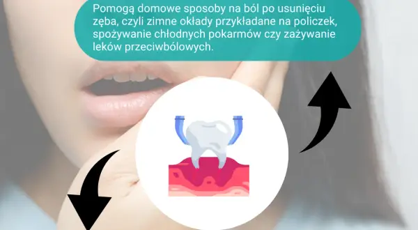 Jak długo boli po usunięciu zęba i jak szybko złagodzić nieprzyjemne dolegliwości