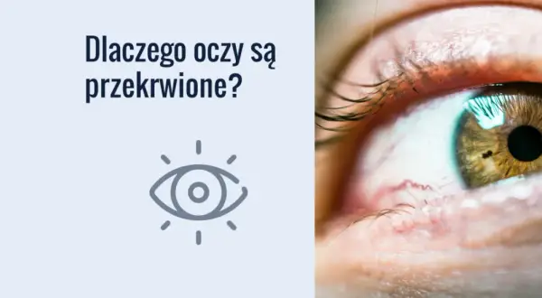 Dlaczego konie mają zasłonięte oczy? Powody, korzyści i zastosowanie klapek