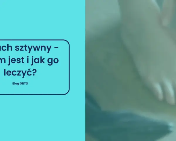 Paluch sztywny – co to za schorzenie i jak sobie z nim radzić? Na zdjęciu widać stopę, która może cierpieć z powodu tej dolegliwości.