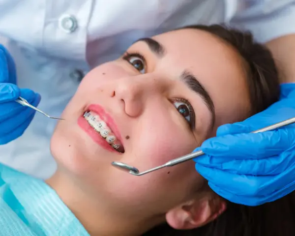 Młoda kobieta z aparatem ortodontycznym na zębach podczas wizyty u ortodonty. Dentysta w niebieskich rękawiczkach bada jej uśmiech.