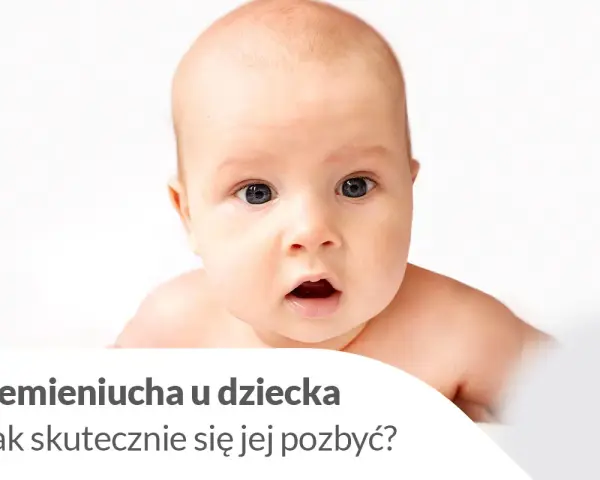 Urocze niemowlę z zaciekawioną miną. Tekst informuje o ciemieniuchy u dziecka i sposobach jej usuwania.