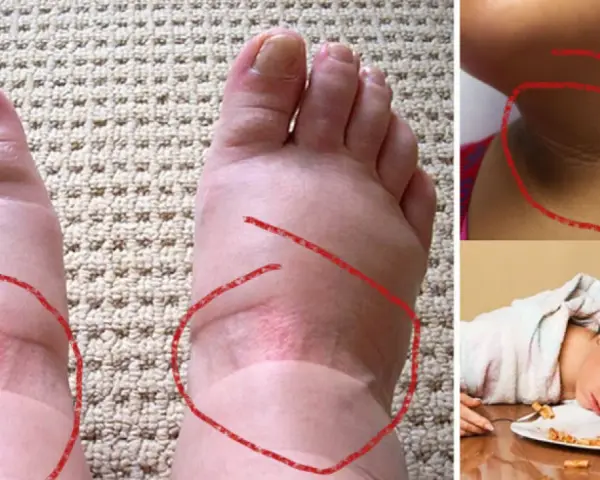Niski poziom insuliny objawy – jak je rozpoznać i co oznaczają?