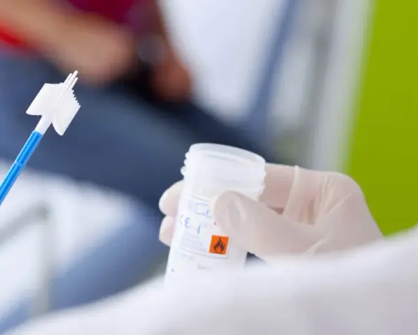 Ręka w rękawiczce trzyma pojemnik z płynem do cytologii. Obok leży specjalna szczoteczka do pobierania wymazu.