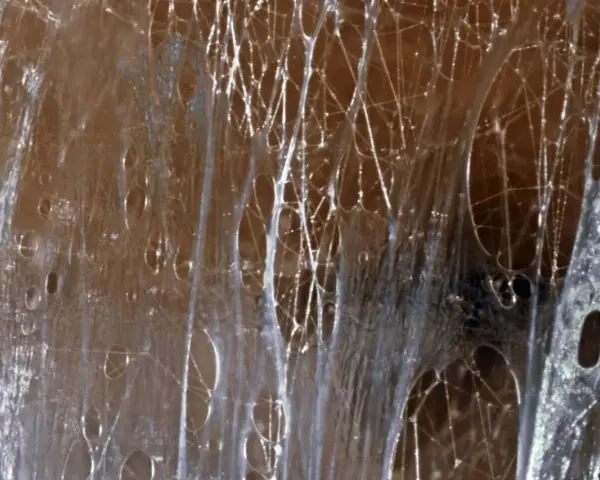 Nahaufnahme von verklebten Faszien, die an ein Spinnennetz erinnern. Medikamente gegen verklebte Faszien können hier helfen, die Elastizität wiederherzustellen.