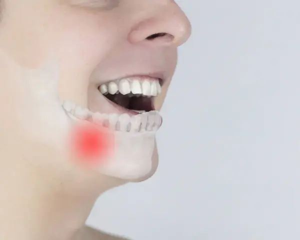 Ból szczęki z zaczerwienieniem sugeruje zapalenie okostnej.