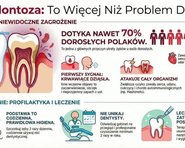Ilustracja przedstawia przekrój zęba z widocznymi problemami dziąseł, bakterie i objawy paradontozy.