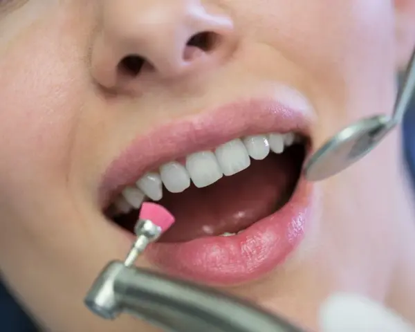 Zabieg fluoryzacji z użyciem szczoteczki i lusterka dentystycznego.