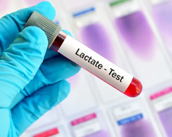Ręka w niebieskiej rękawiczce trzyma probówkę z krwią do testu na mleczany. Wynik może pomóc zdiagnozować kwasicę mleczanową.