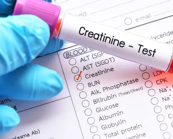 Rękawiczka w niebieskiej rękawiczce trzyma probówkę z napisem "Creatinine - Test". Obok zaznaczono "Kreatynina co to za badanie".