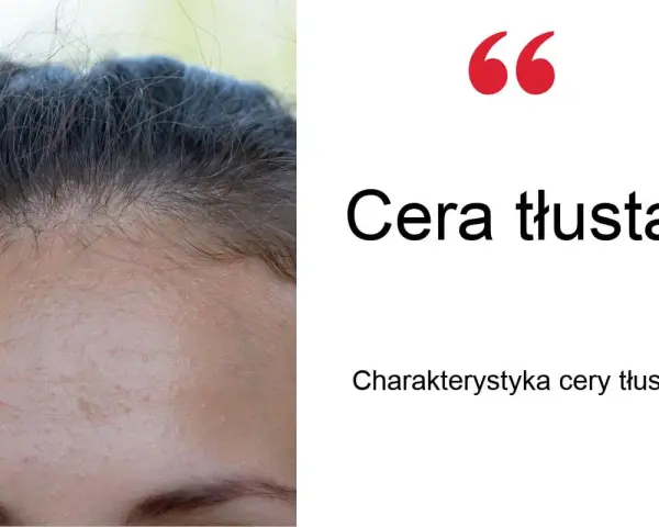 Tłusta cera? Poznaj sprawdzone sposoby na matową skórę bez błyszczenia.