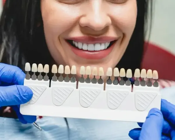 Uśmiechnięta kobieta z paletą odcieni zębów w rękach dentysty w niebieskich rękawiczkach.