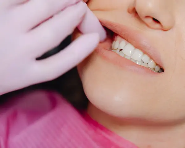 Ruszający się ząb stały? Nie wyrywaj! Pilna pomoc dentysty