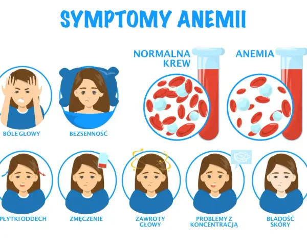Objawy anemii u niemowlaka: bóle głowy, bezsenność, płytki oddech, zmęczenie, zawroty głowy, problemy z koncentracją, bladość skóry.