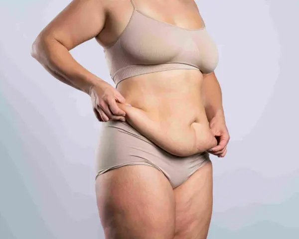 Kobieta w bieliźnie pokazuje fałdy brzuszne, rozważając abdominoplastykę.