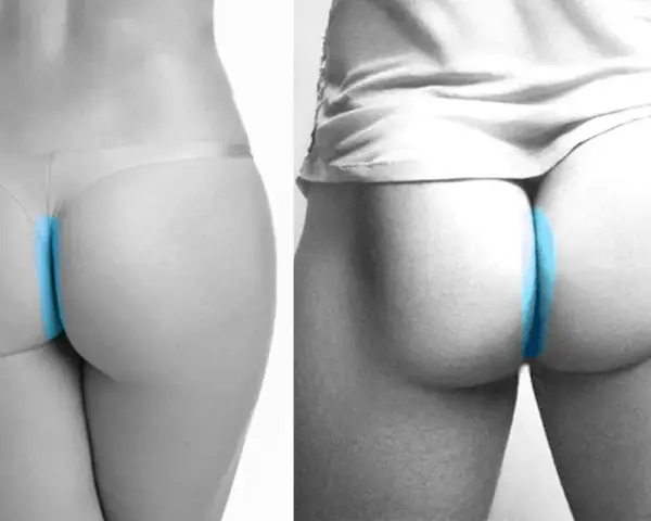 Dos imágenes comparan la depilación anal, una con ropa interior y otra sin ella, resaltando la zona con azul.