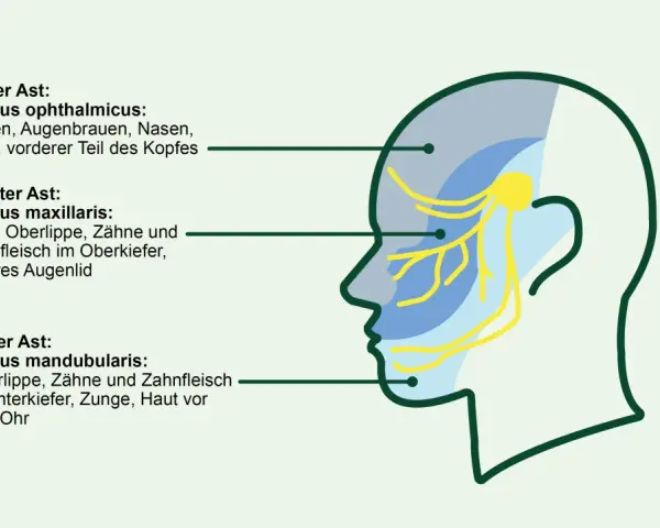 Schema des Trigeminusnervs mit seinen drei Ästen, die verschiedene Gesichtsbereiche versorgen. Eine sanfte Massage kann hier Linderung verschaffen.