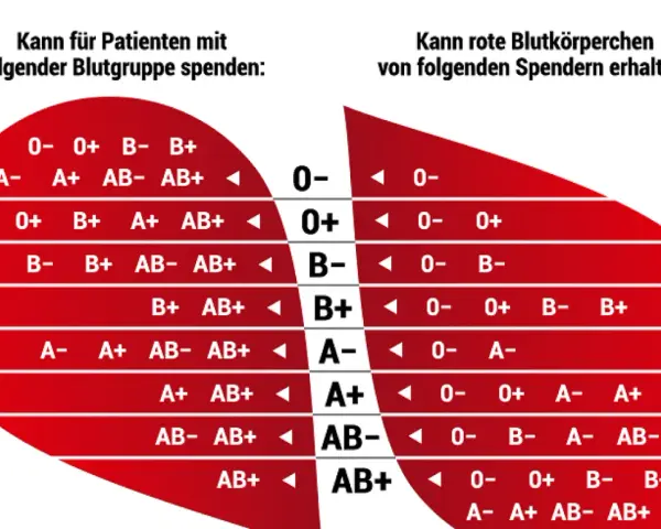 Blutgruppe 0 positiv ist ein universeller Spender. Die Tabelle zeigt, wer von wem Blut erhalten kann.