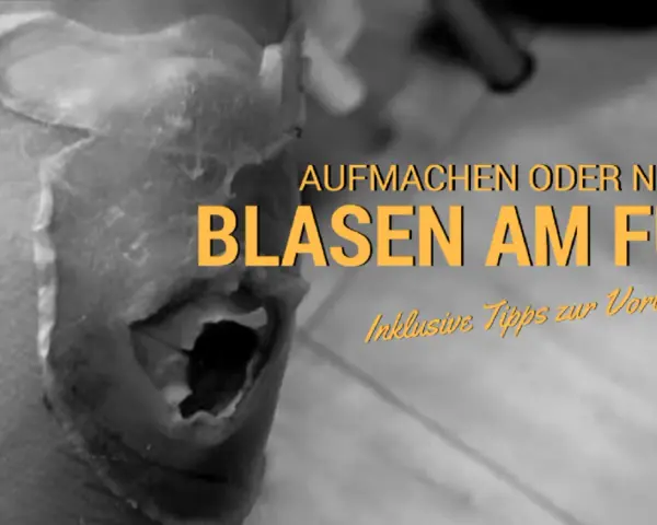 Nahaufnahme eines Fußes mit einer großen, offenen Blase. Text: "Aufmachen oder nicht? Blasen am Fuß. Inklusive Tipps zur Vorbeugung.