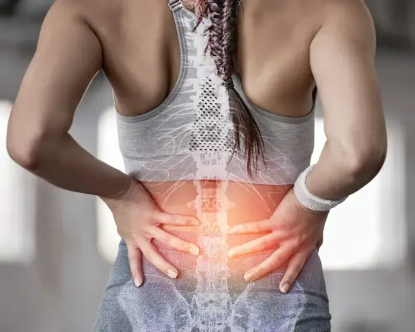 Kobieta z bólem w odcinku lędźwiowym kręgosłupa, wskazującym na dyskopatię lędźwiową i jej objawy neurologiczne.