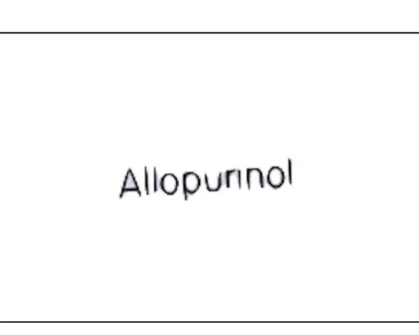 Napis "Allopurinol" na białym tle. Lek Milurit 300 pomaga w leczeniu dny moczanowej.