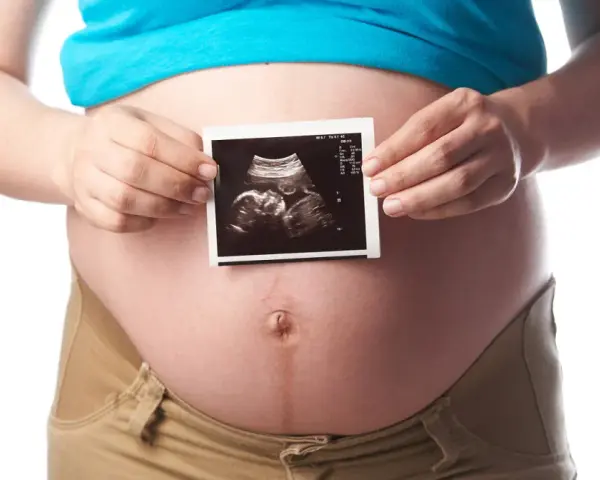 Schwanger in der 21. SSW: Ein Ultraschallbild zeigt das Baby.