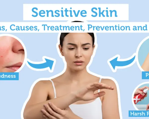Infographic on sensitive skin, showing redness, hydration, patch testing, and avoiding harsh products. Essential skincare tips for sensitive skin.