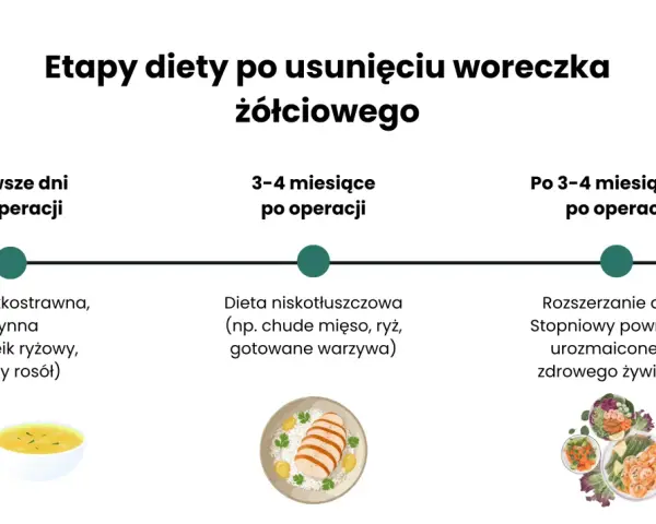 Etapy diety po usunięciu woreczka żółciowego: od płynnej, lekkostrawnej, przez niskotłuszczową, do stopniowego powrotu do zdrowego żywienia.