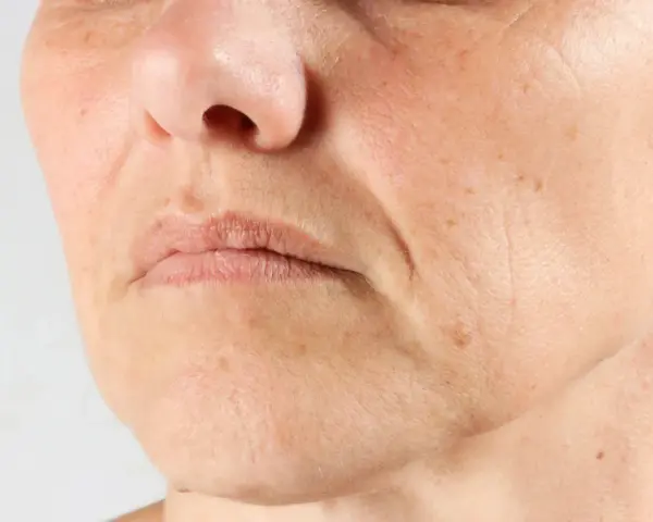 Nahaufnahme eines Gesichts mit sichtbaren Falten um den Mund. Die Frage "Falten ab wann?" beschäftigt viele.