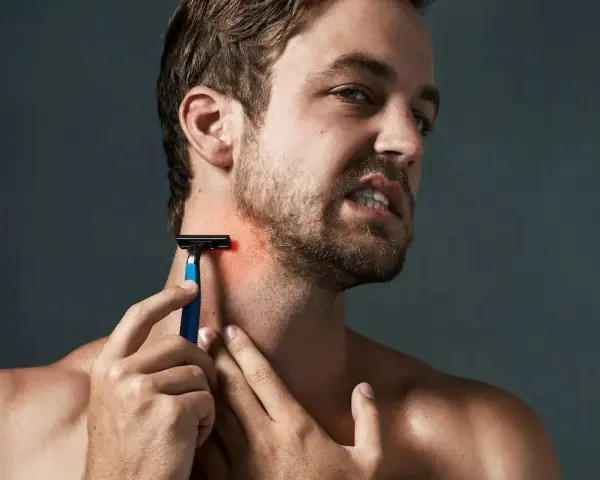 Hombre con piel irritada afeitado, se rasca el cuello con una navaja de afeitar azul.