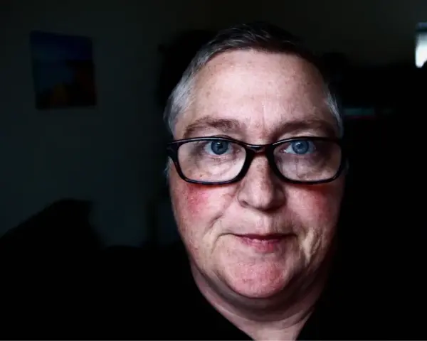 Mężczyzna z niebieskimi oczami i okularami. Jego **czerwona twarz** emanuje ciepłem, a na policzkach widać rumieńce.