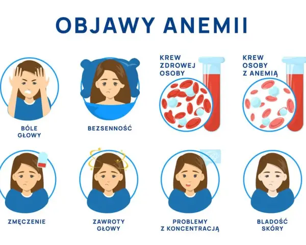 Anemia objawy psychiczne: jak niedokrwistość wpływa na twoje samopoczucie
