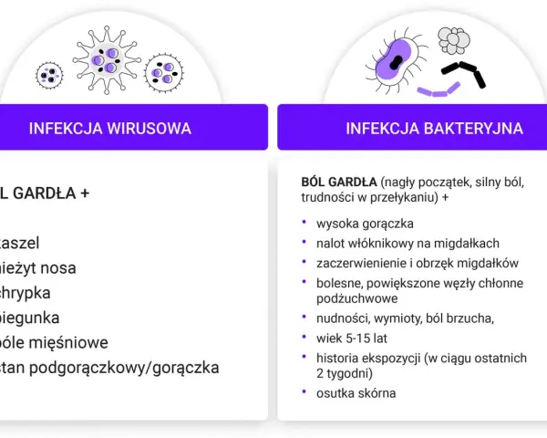 Infekcja wirusowa vs. bakteryjna: ostry ból gardła przy przełykaniu bez gorączki towarzyszy wirusom, w przeciwieństwie do infekcji bakteryjnej z gorączką.