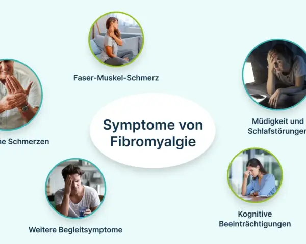 Fibromyalgie erfahrungen: Chronische Schmerzen, Faser-Muskel-Schmerz, Müdigkeit, Schlafstörungen und kognitive Beeinträchtigungen sind häufige Symptome.