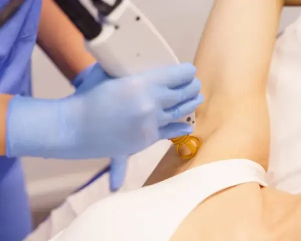 Depilacja laserowa: czy boli? Poznaj prawdę i metody łagodzenia bólu