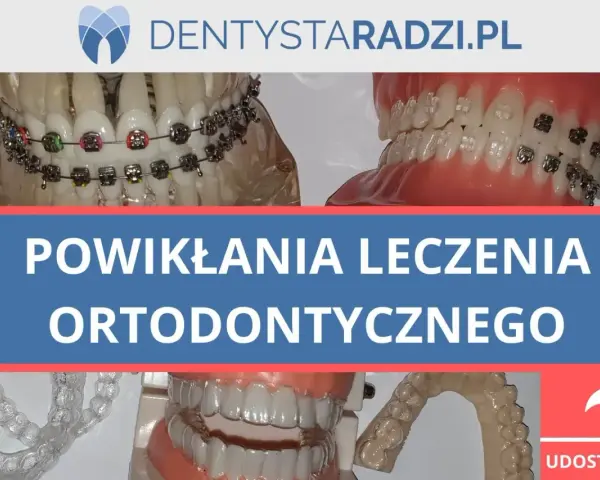 Ból zębów po aparacie? Szybka ulga i porady ortodonty!