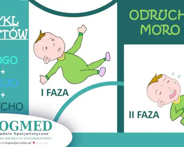 Ilustracja przedstawia dwie fazy odruchu Moro u niemowląt: pierwszą, gdzie dziecko jest wyciągnięte, i drugą, gdzie płacze.