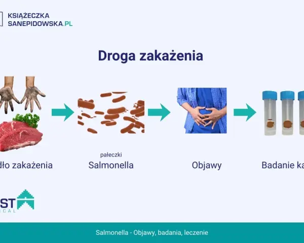 Droga zakażenia Salmonellą: od surowego mięsa i brudnych rąk, przez pałeczki, do objawów bólu brzucha i badania kału.