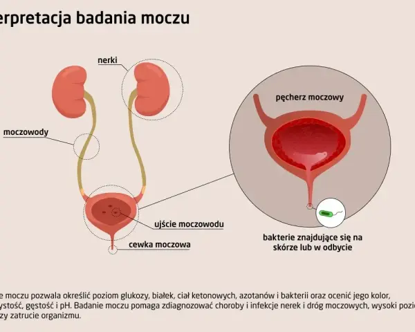 Ilustracja układu moczowego z zaznaczonymi nerkami, moczowodami i pęcherzem. Powiększenie pokazuje bakterie w pobliżu ujścia cewki moczowej, sugerując obecność bakterii w moczu.
