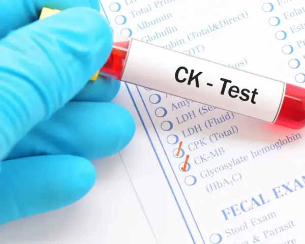 Rękawiczka trzyma probówkę z krwią do testu CK. Na formularzu zaznaczono kinazę kreatynową 400.