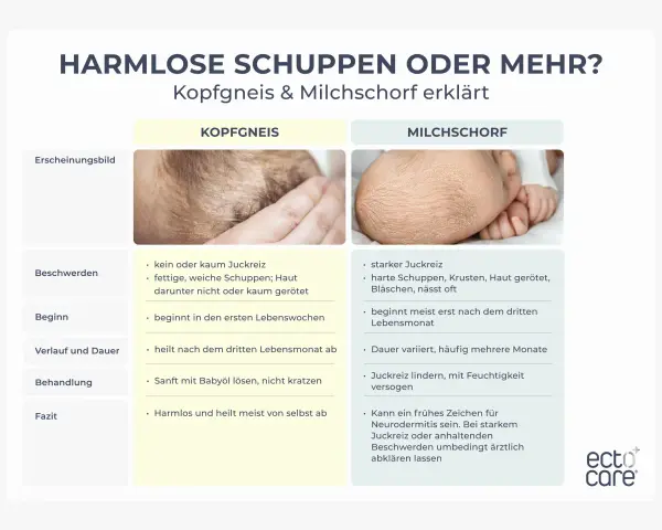 Baby kratzt sich am Kopf wegen Kopfgneis oder Milchschorf. Die Bilder zeigen die Unterschiede.