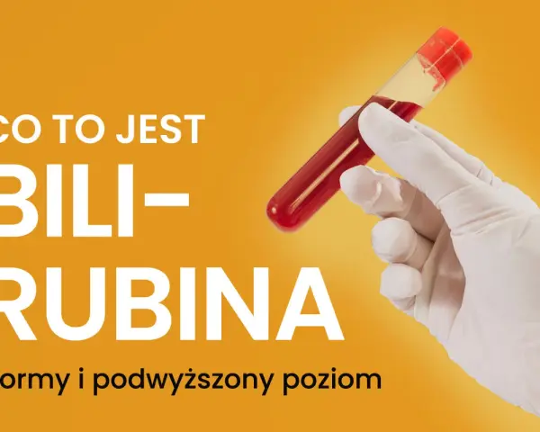 Ręka w rękawiczce trzyma probówkę z krwią. Tekst informuje o tym, czym jest bilirubina i kiedy jej poziom jest podwyższony.