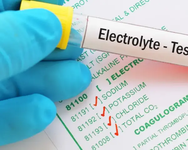 Ręka w niebieskiej rękawiczce trzyma probówkę z oznaczeniem "Electrolyte - Test" nad formularzem z badaniami, w tym jonogramem.