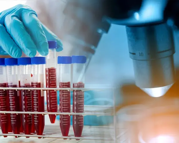 Rękawiczka laboratoryjna trzyma probówkę z krwią na tle mikroskopu.