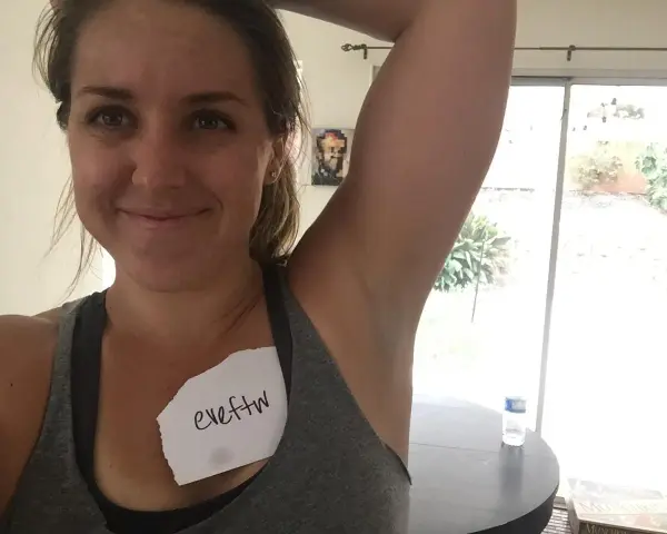 Kvinna visar sin armhåla, som har viss hyperpigmentering. En lapp med texten "eveftw" sitter på hennes bröst.