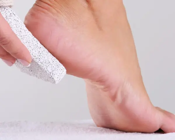 Piedra pómez exfolia el talón para eliminar olor de pies para siempre.
