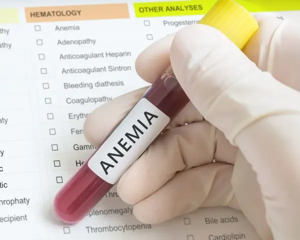 Badanie krwi potwierdza niskie erytrocyty w ciąży. Wynik wskazuje na anemię, która wymaga dalszej diagnostyki.