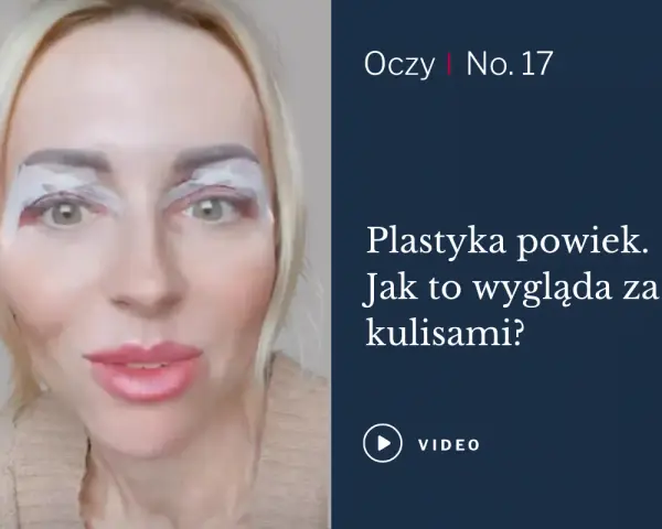 Kobieta z plastrem na powiekach górnych, przygotowująca się do zabiegu korekty powiek.